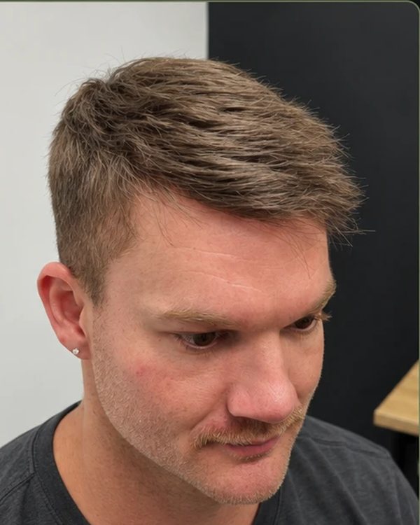 The same client after Tuffs