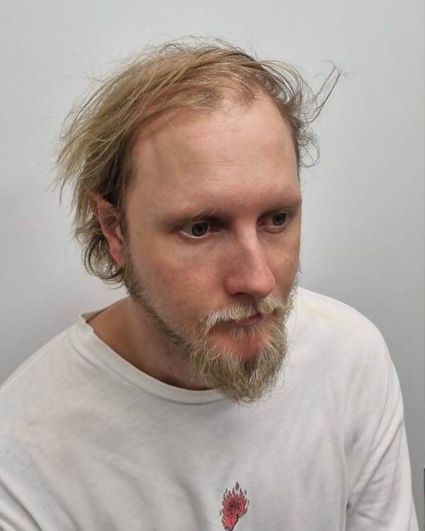 A Tuffs client before his hair system